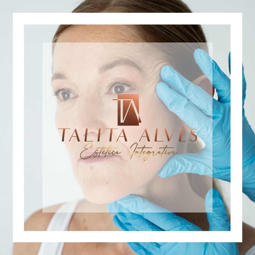 Preenchimento de Malar Clinica de Estética