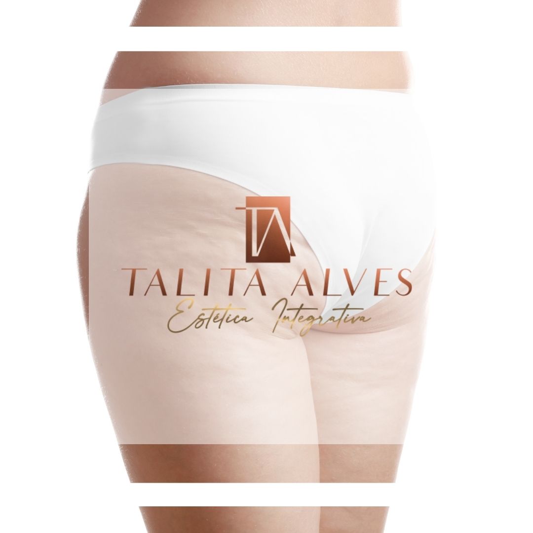 Qual a Melhor Clínica Tratamento Celulite SP