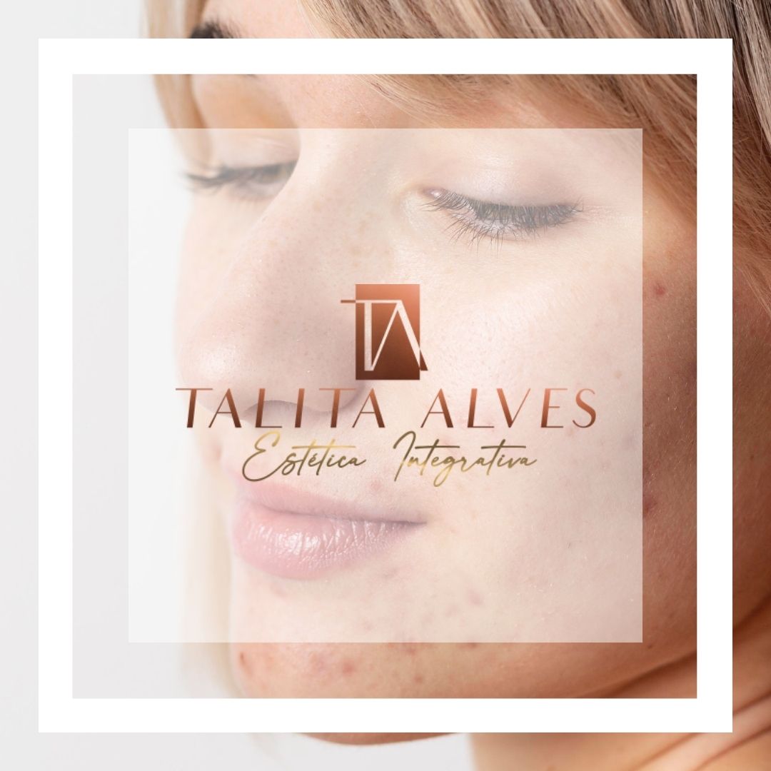 Qual a Melhor Clínica Tratamento Cicatrizes e Manchas Acne SP