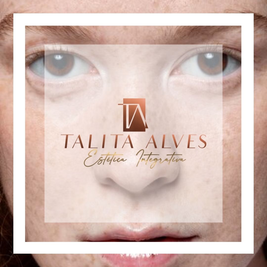 Qual a Melhor Clínica Manchas e Melasma SP