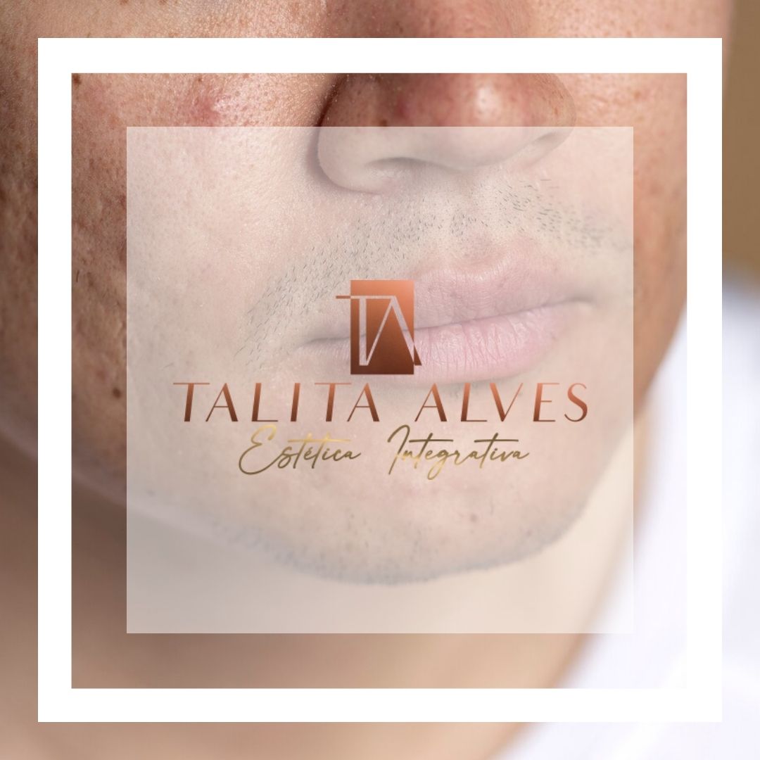 Cicatrizes e Manchas