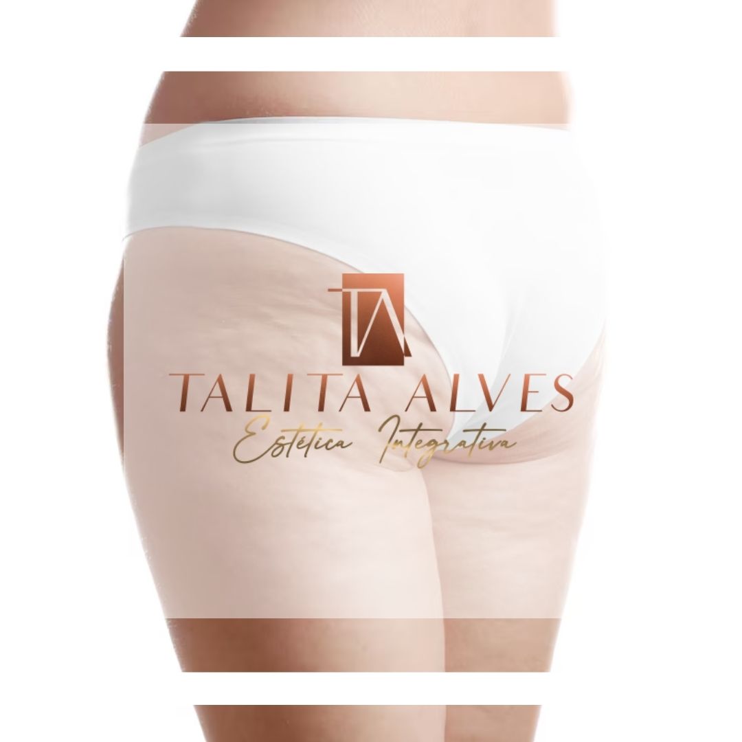 Celulite Tratamento Perto de Mim