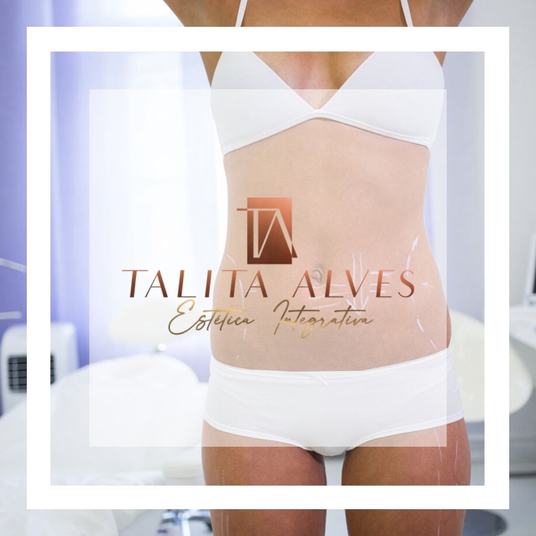 Tratamento Gordura Localizada Perto de Mim