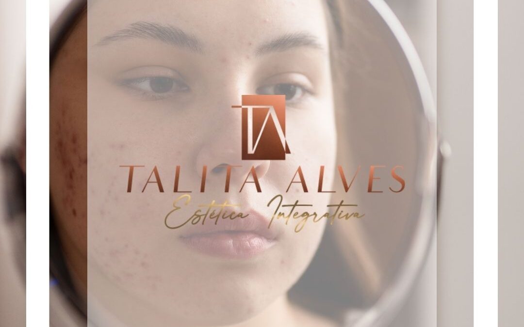 Cicatrizes e Manchas da Acne Perto de Mim