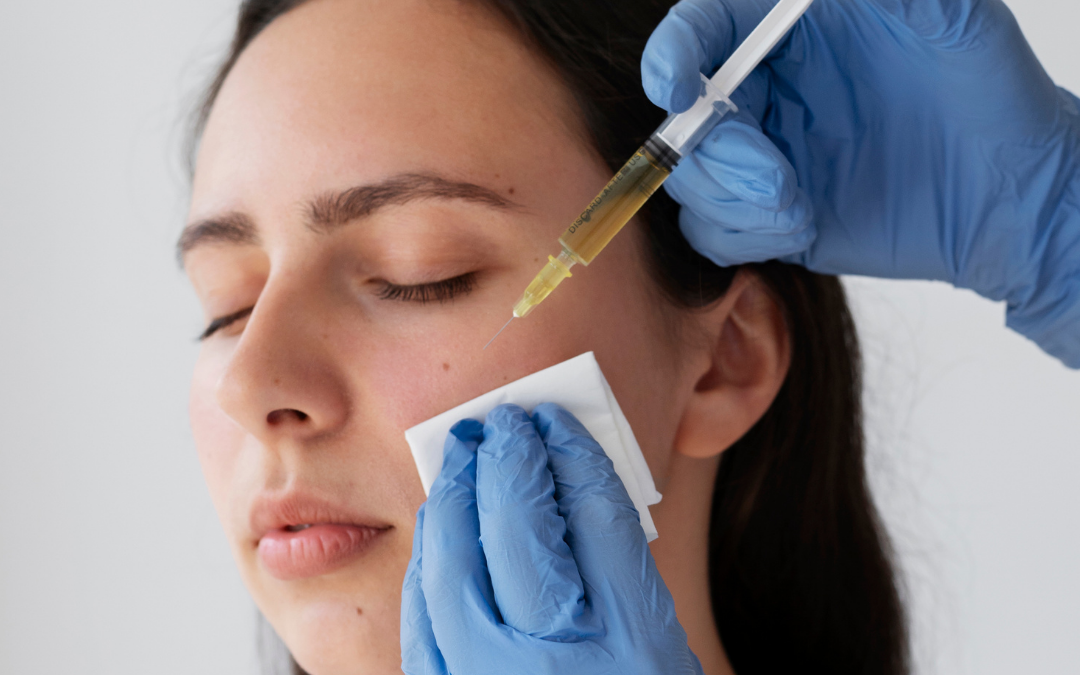 Bioestimulador de Colágeno Clínica Talita Alves