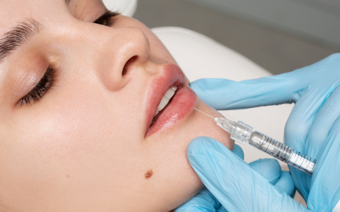 Preenchimento labial Clinica Talita Alves
