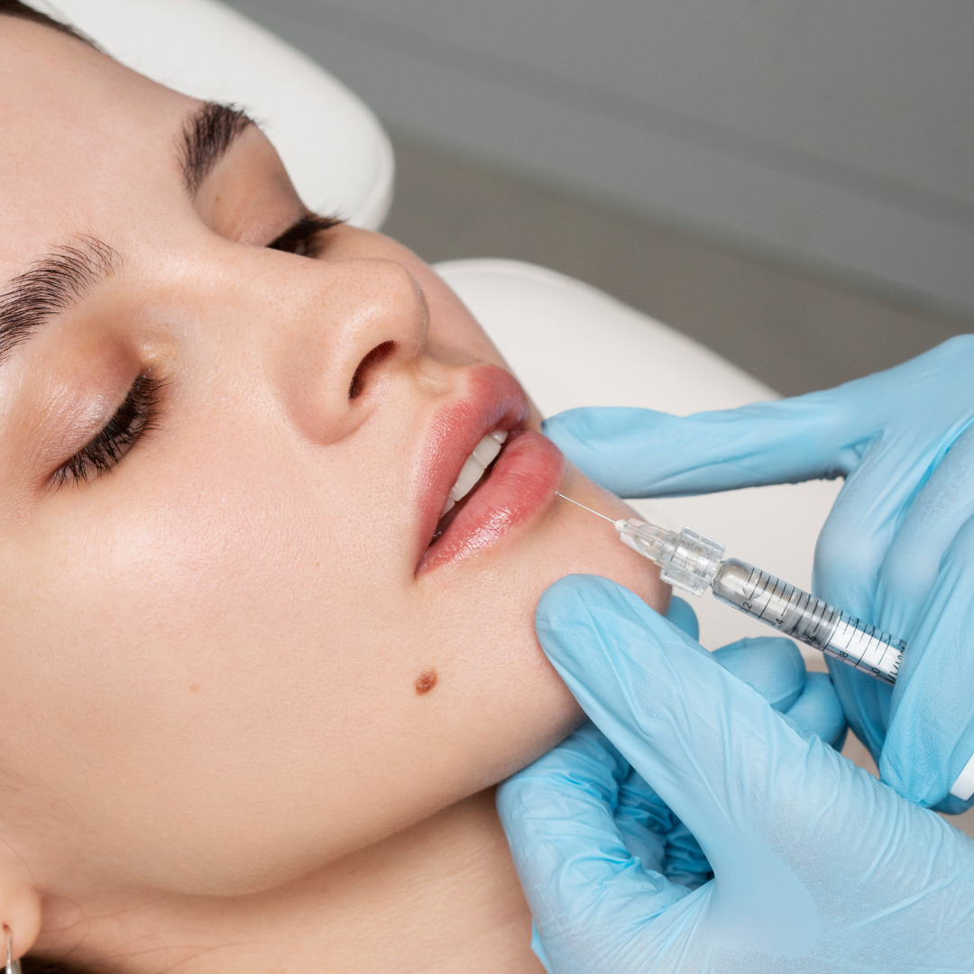 Preenchimento labial Clinica Talita Alves