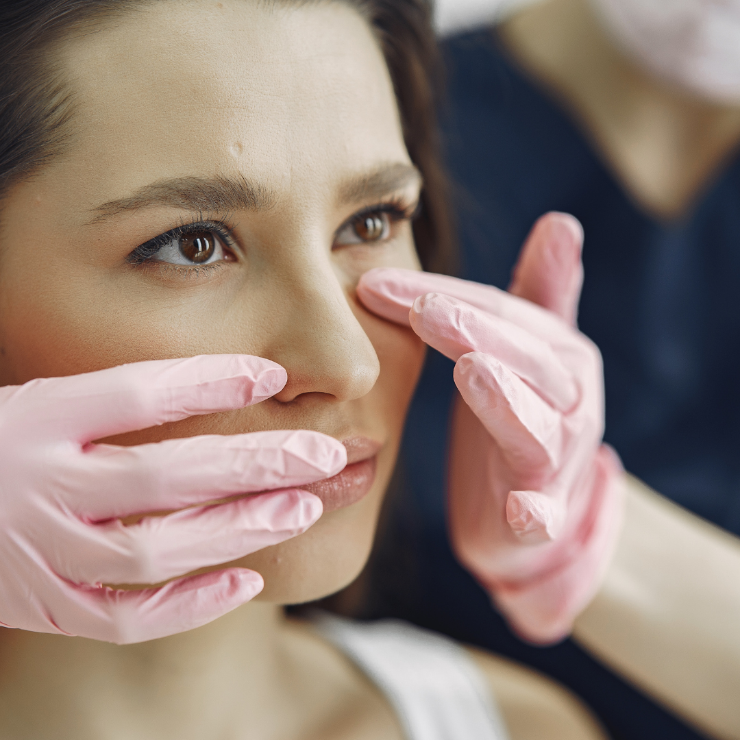 Preenchimento de Olheiras Clinica Talita Alves