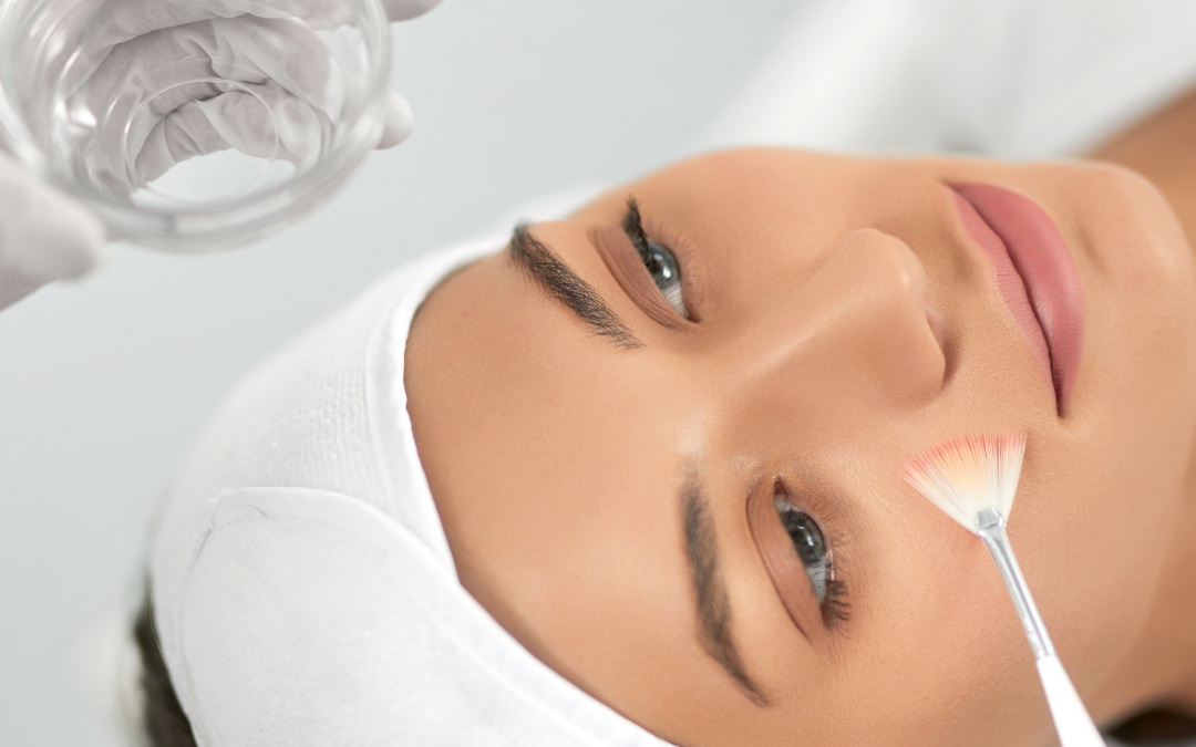 Peeling Químico Clínica Talita Alves