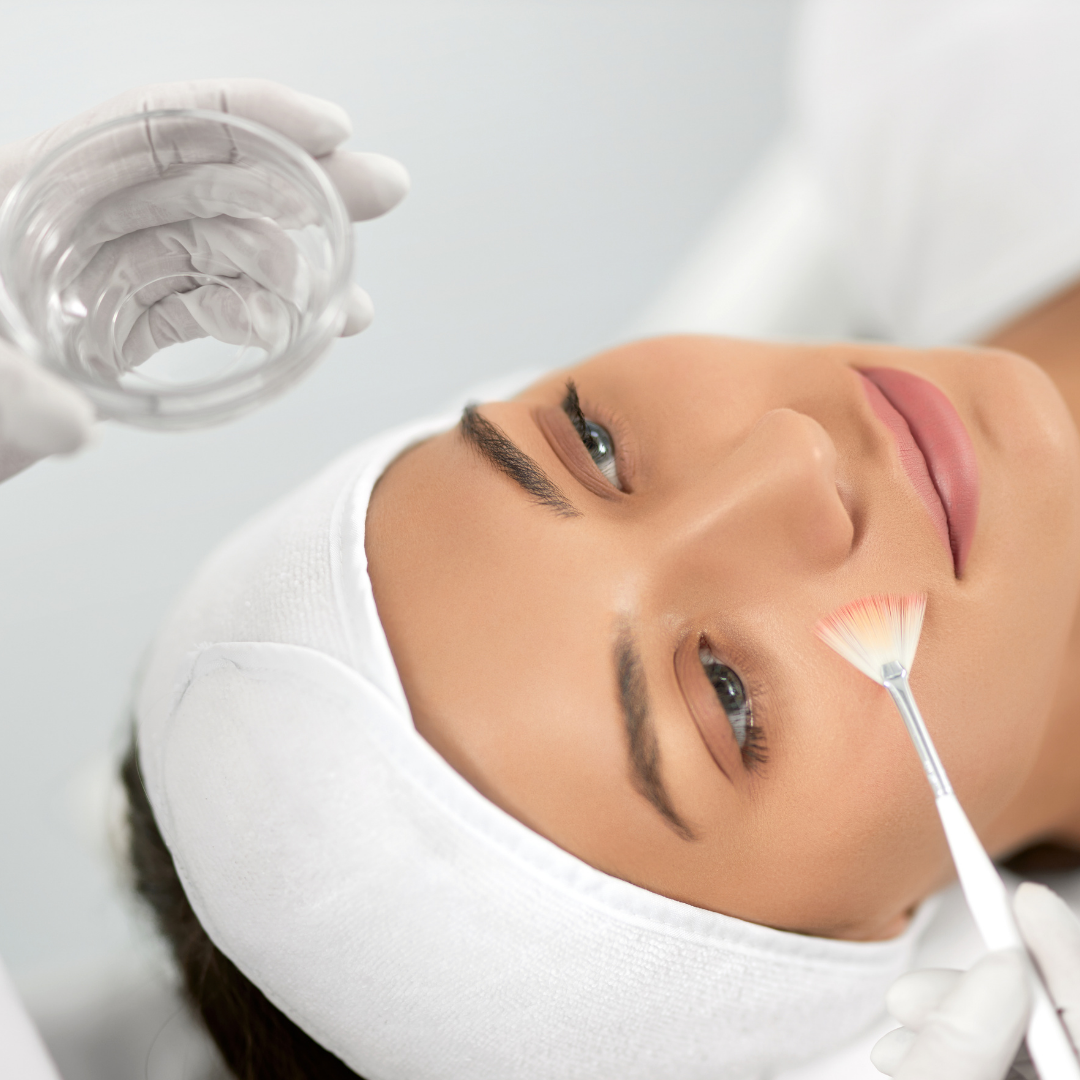 Peeling Químico Clínica Talita Alves