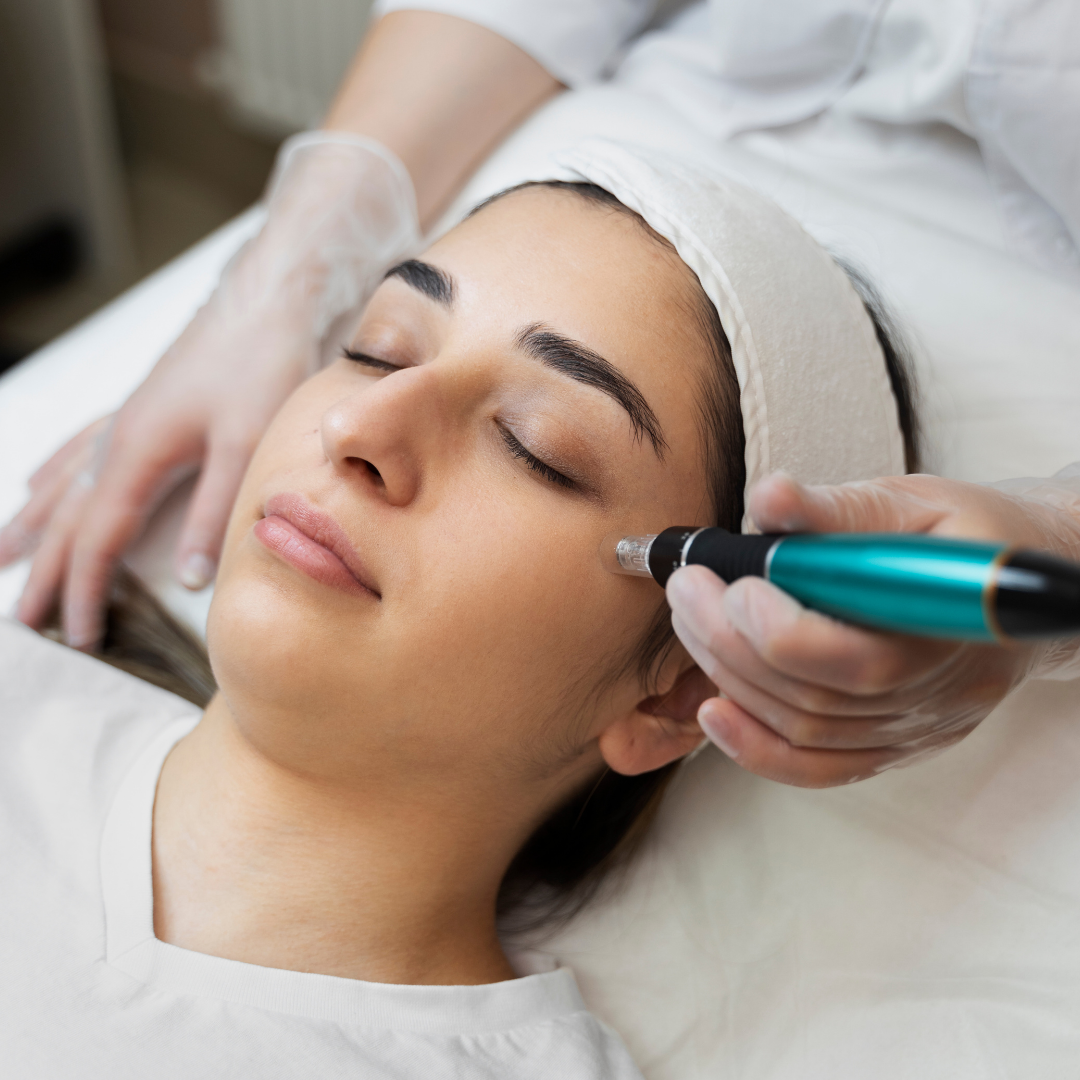 Peeling de Diamante Clínica Talita Alves
